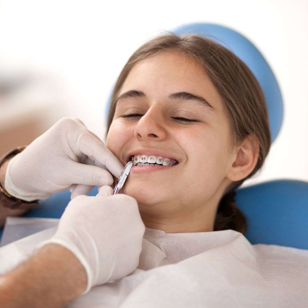 Fiksni aparatic za djecu 2