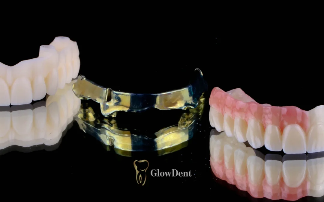 Wie viel kostet die All-on-4-Behandlung und welche Faktoren beeinflussen den Preis?