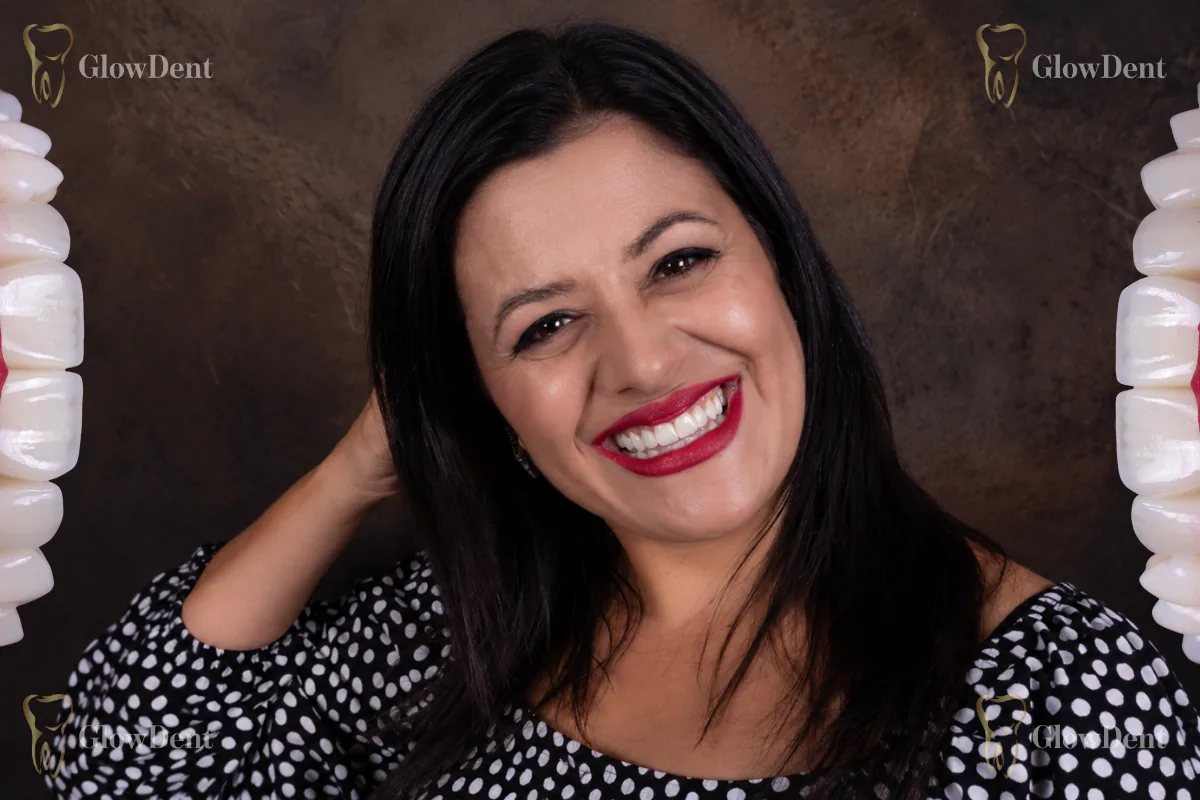 Novi osmijeh nakon terapije implantatima i krunicama u GlowDentu Banja Luka